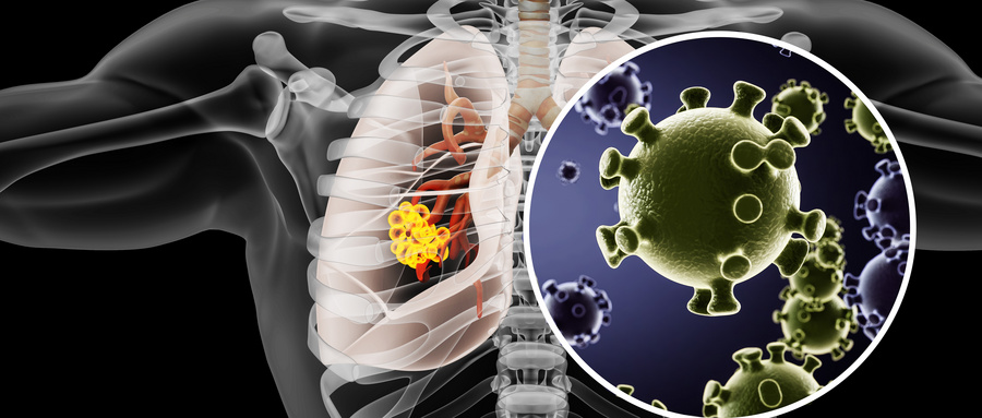 庞小平主任：肺部有病，睡觉时会有5种异常！