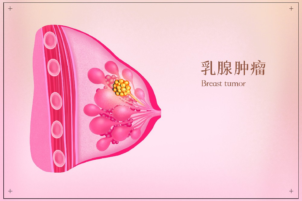 摄图网_401802620_乳腺肿瘤医疗插画（企业商用）.jpg