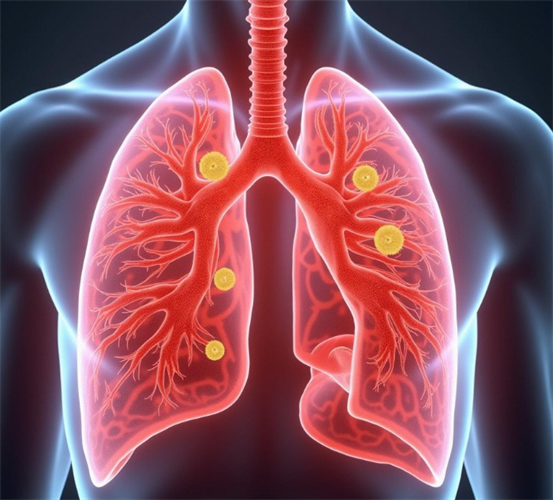 成都普济中医药研究院中医门诊部看肺肿瘤效果怎么样-中医药可以治疗肺肿瘤吗？