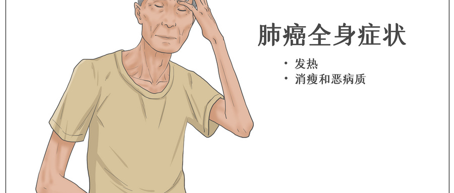 四川治疗肺癌好的中医丨晚期肺癌患者选择中医，不止止痛，更重 “有质量的生存”